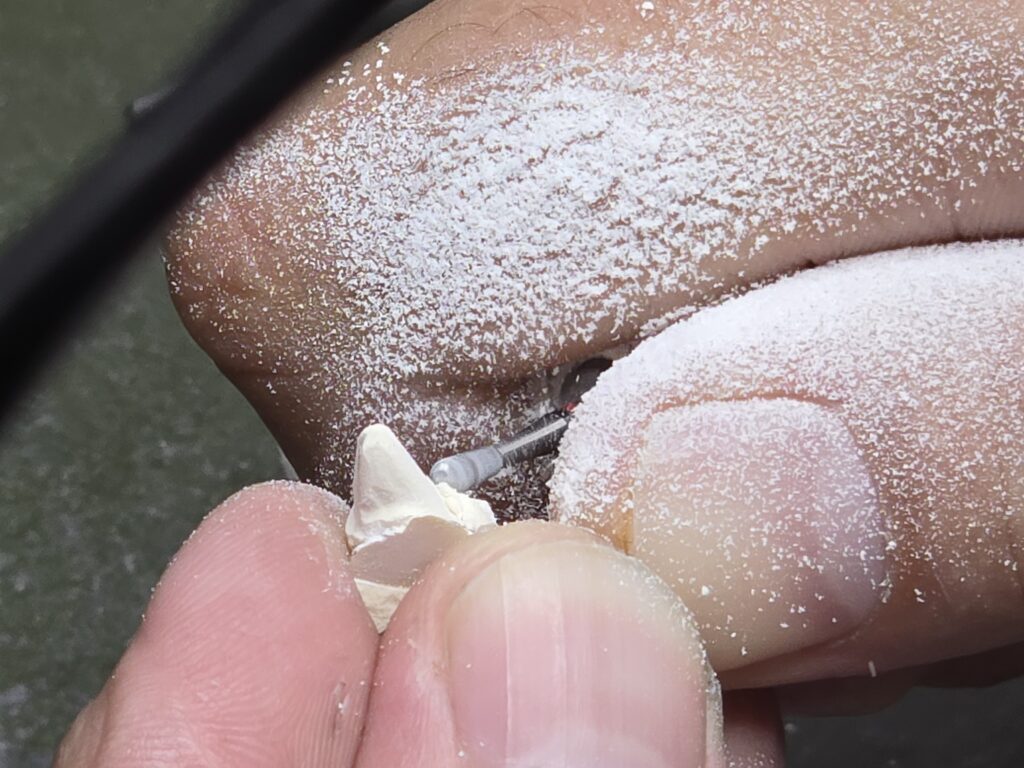 Cun ina gliema elaborescha e fuorma Benjamin Janki il dent artificial.