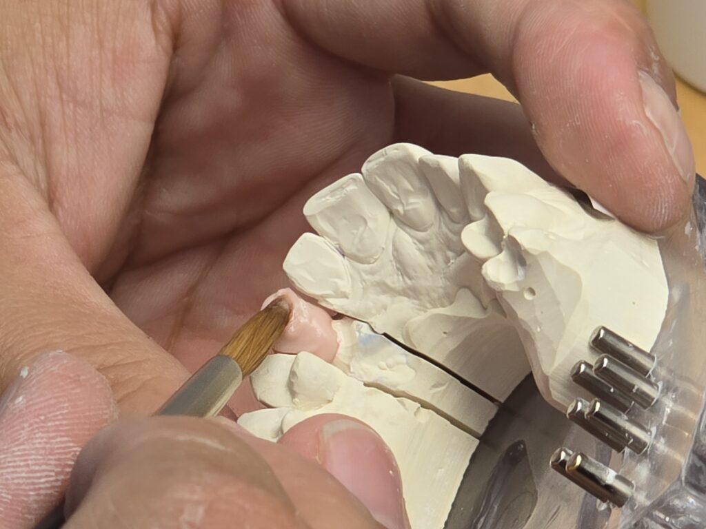 Dar colur alla protesa ei in impurtont pass da lavur.