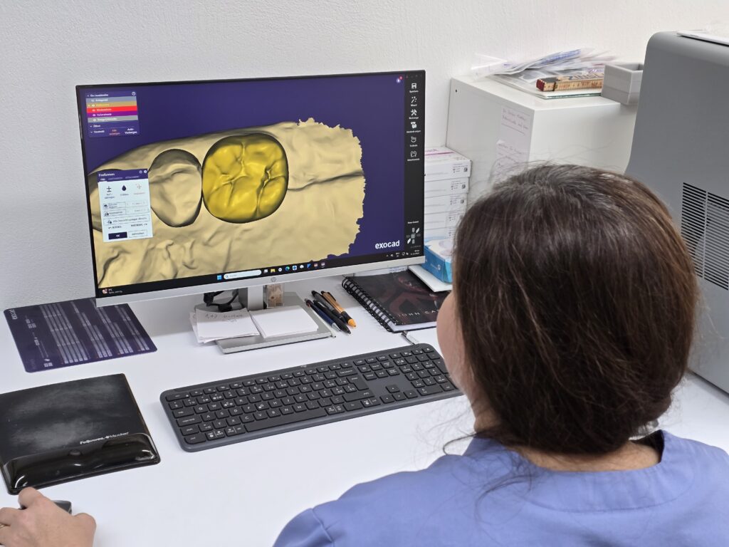 Al computer prepara ina tecnichera ina lavur.