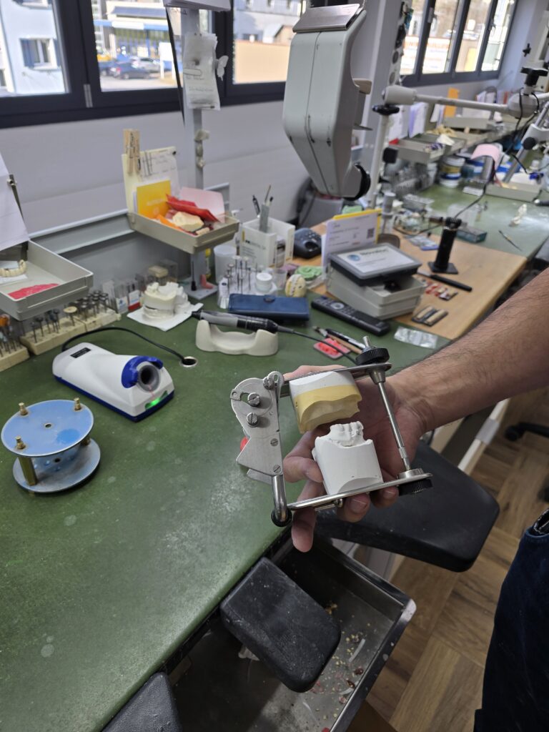 Gl’apparat che simulescha la missiala che semova (davontier).